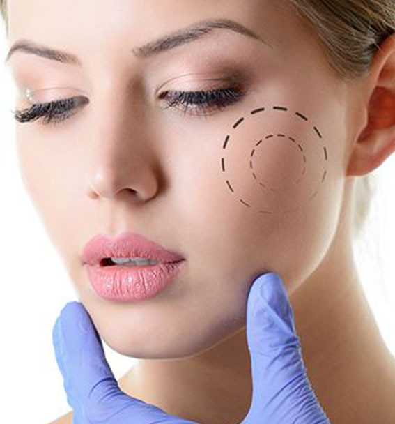 Everything about Cheekbone Reduction Surgery and its Recovery